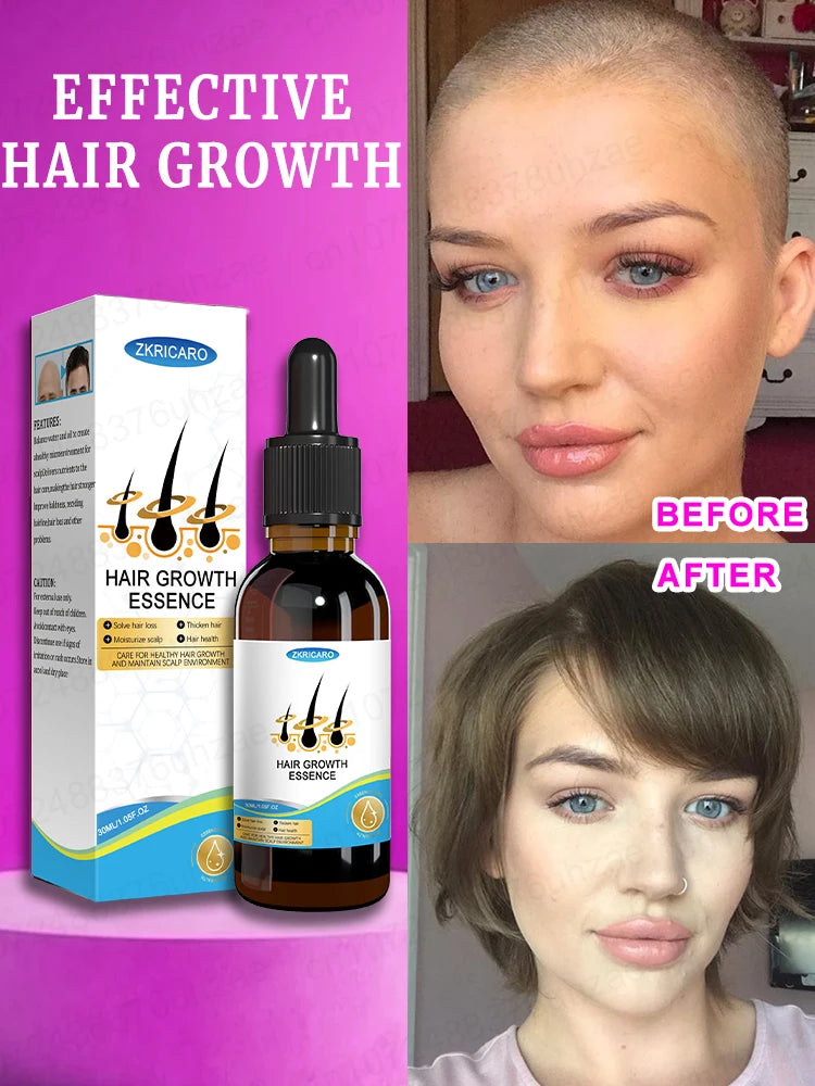 Hair Increasing Serum