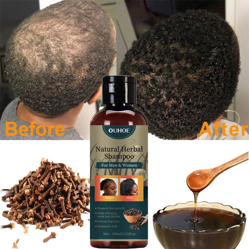 Hair Growth Shampoo Ancient African Hair Growth Formula Extract Powerful Effect Fast Hair Loss Treatment Hair Care 100ml