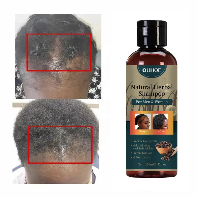 Hair Growth Shampoo Ancient African Hair Growth Formula Extract Powerful Effect Fast Hair Loss Treatment Hair Care 100ml