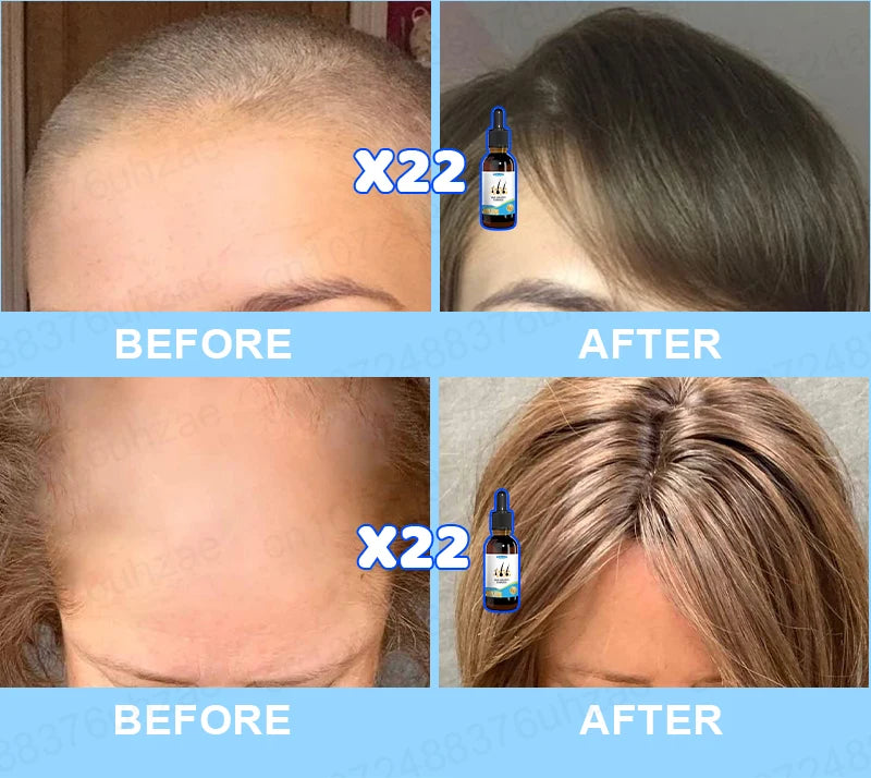 Hair Increasing Serum