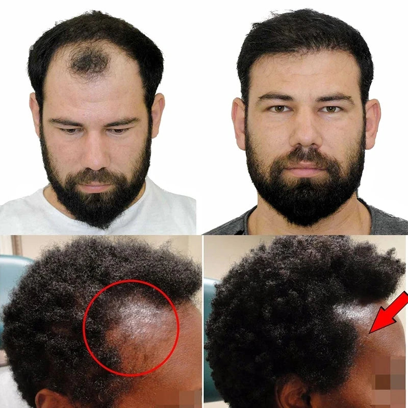 Hair Growth Shampoo Ancient African Hair Growth Formula Extract Powerful Effect Fast Hair Loss Treatment Hair Care 100ml