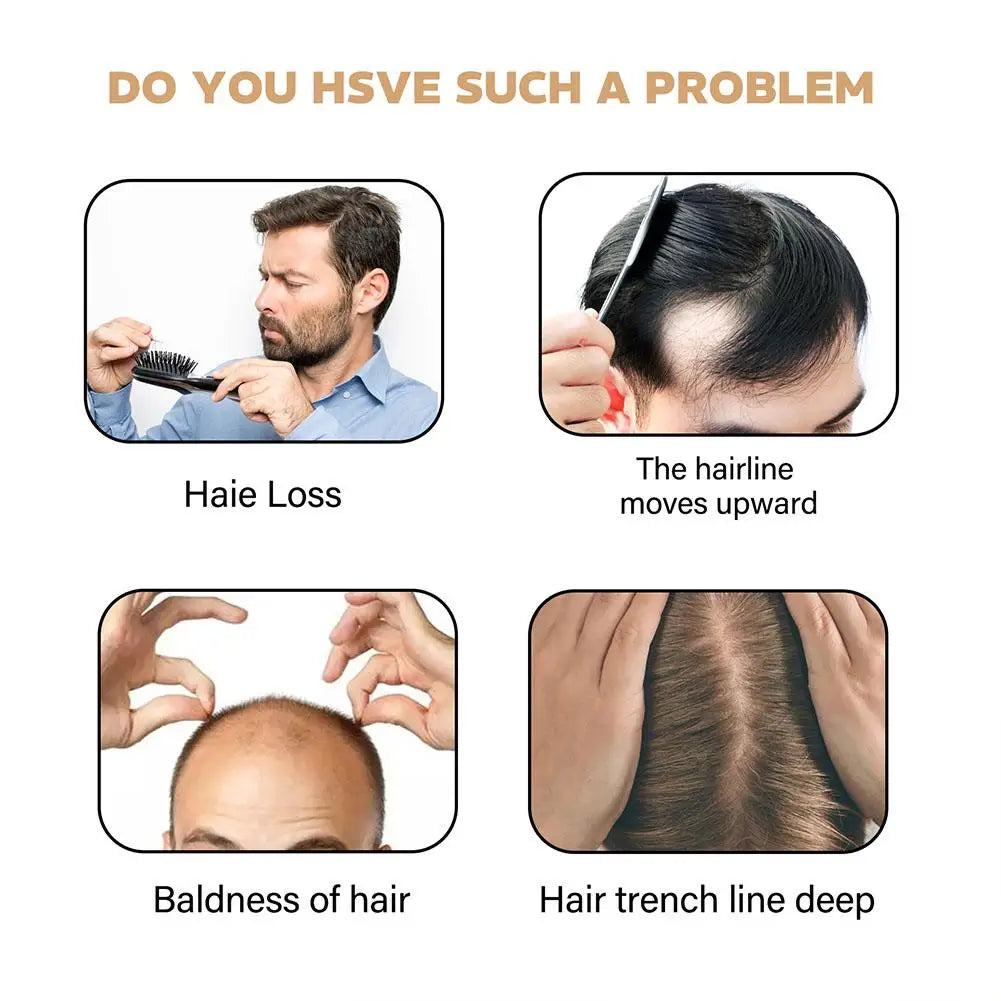 Hair Loss Treatment Shampoo Promotes Growth, Strengthens Roots, Repairs Scalp, Anti-Thinning & Moisturizing Thickening Hair Care