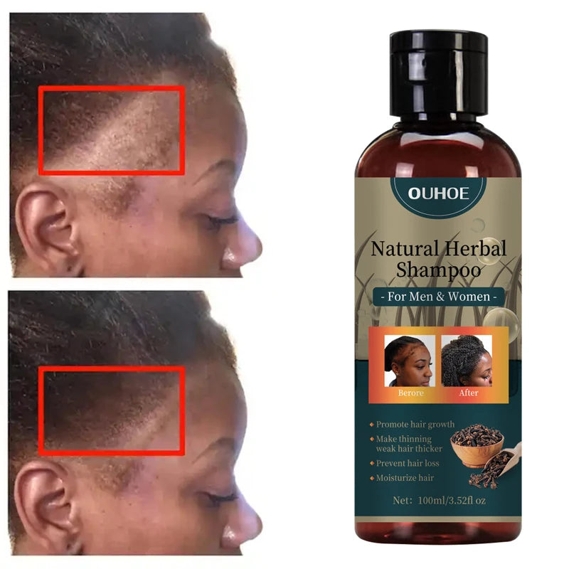Hair Growth Shampoo Ancient African Hair Growth Formula Extract Powerful Effect Fast Hair Loss Treatment Hair Care 100ml
