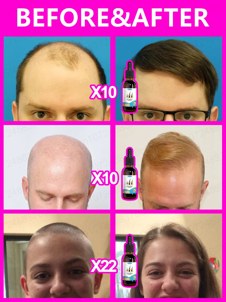 Hair Increasing Serum