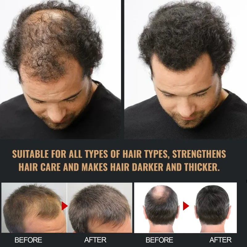 Hair Loss Treatment Shampoo Promote Growth Strengthen Hair Roots Scalp Repair Anti Thinning Moisturizing Thickening Hair Care