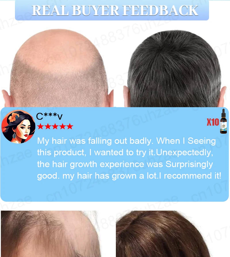 Hair Increasing Serum