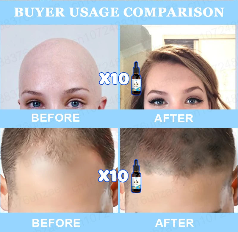 Hair Increasing Serum