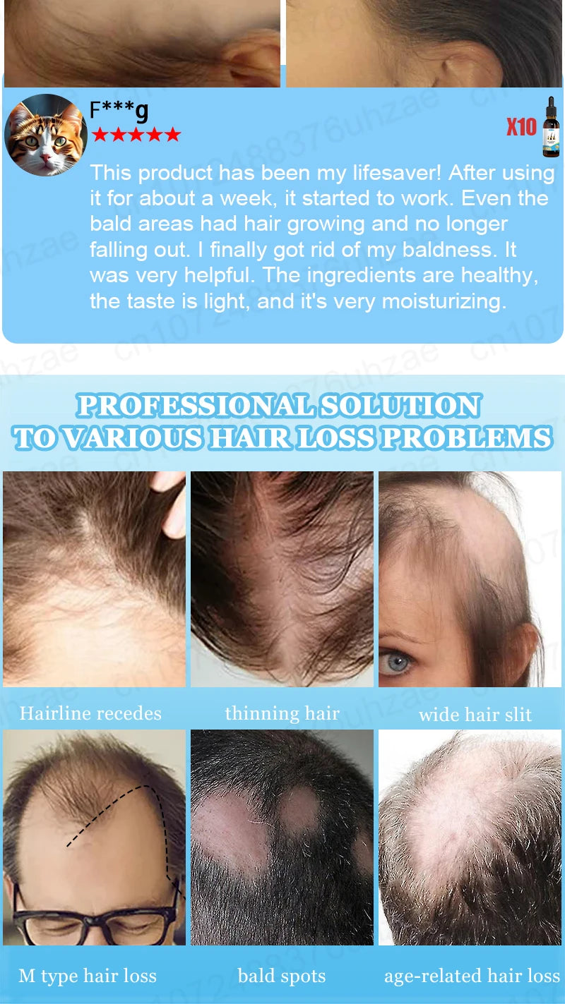 Hair Increasing Serum