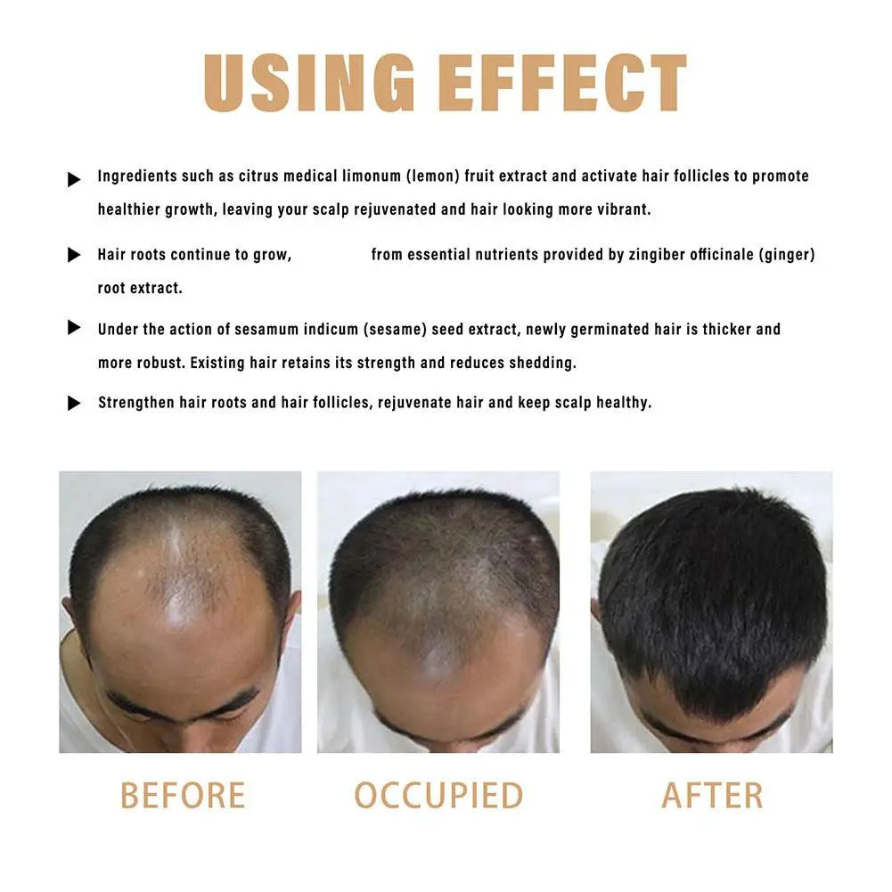 Hair Loss Treatment Shampoo Promotes Growth, Strengthens Roots, Repairs Scalp, Anti-Thinning & Moisturizing Thickening Hair Care